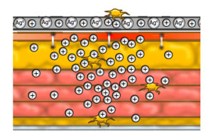 Ion-Chart1