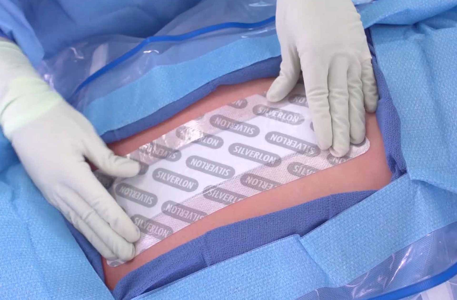 Silver antimicrobial wound dressings silverlon eu