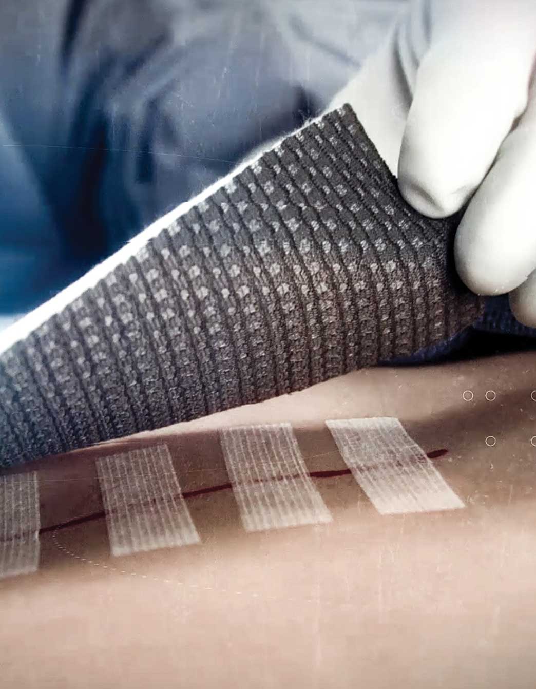 Silver antimicrobial wound dressings silverlon eu