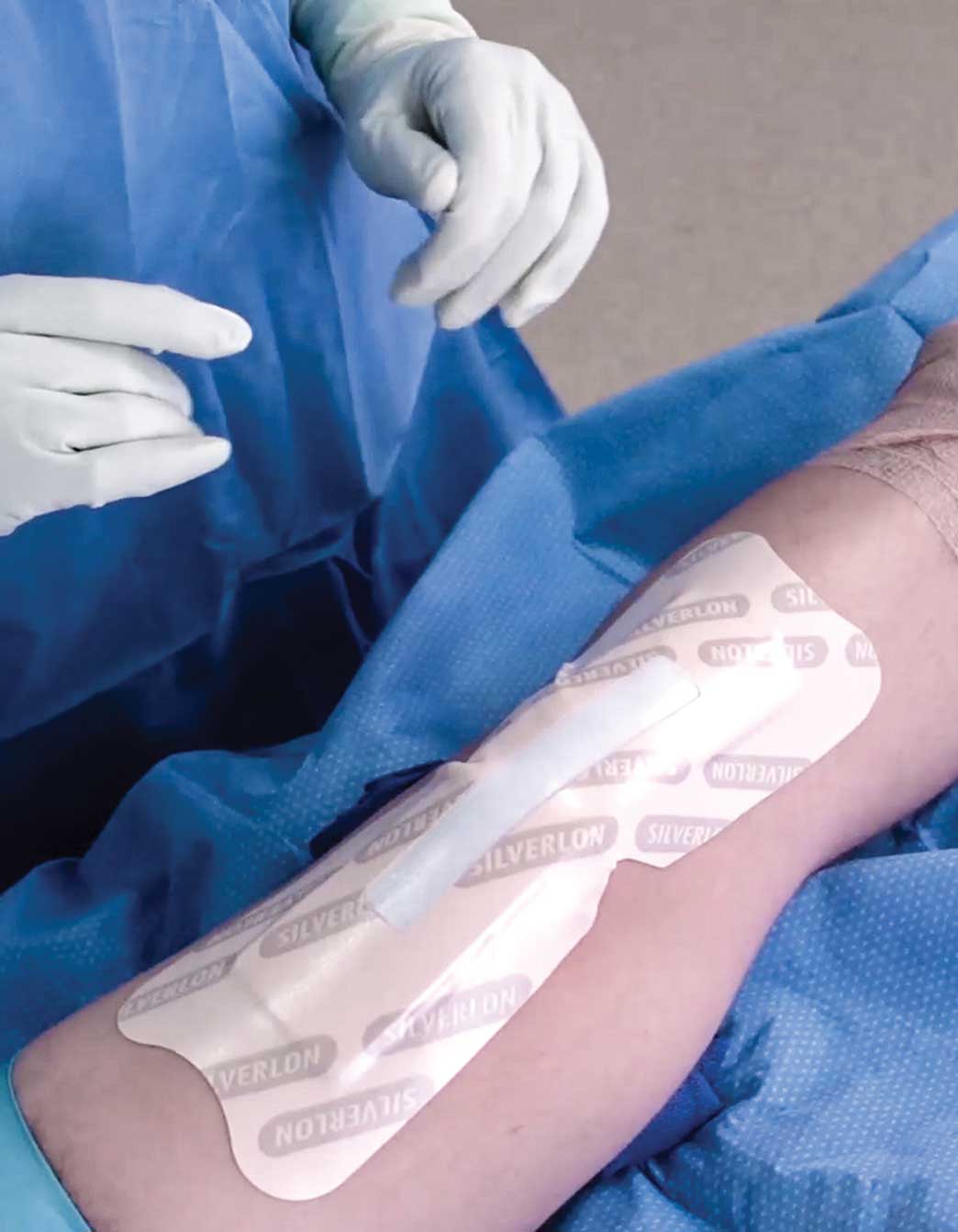 Buy Silver Wound Dressings